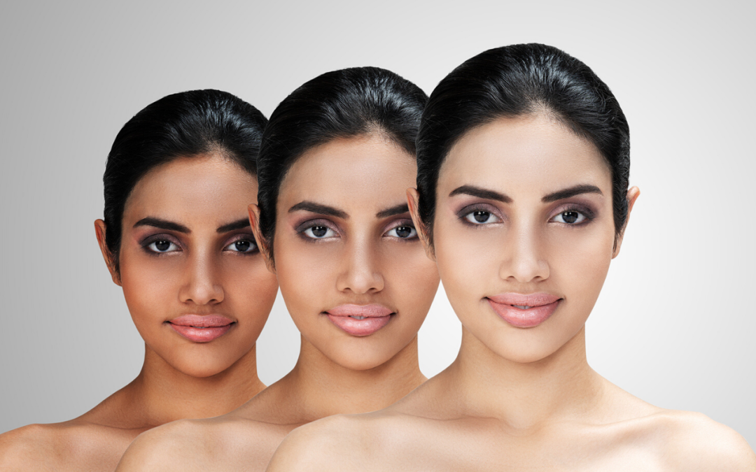 Treatments for Skin Whitening and Brightening