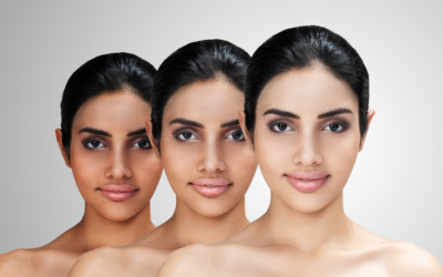 Different Treatments for Skin Whitening and Brightening