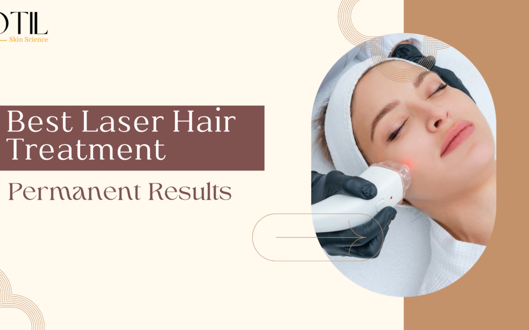 Best Laser Hair Treatment