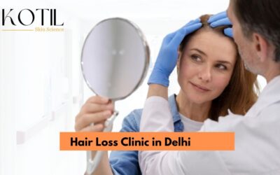 Choosing the Right Hair Loss Clinic in Delhi: A Patient’s Guide