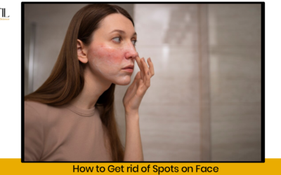 How to get rid of spots on face