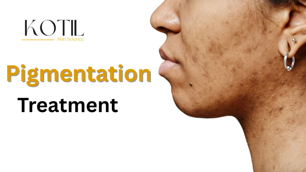 Pigmentation Skin Expert in Delhi