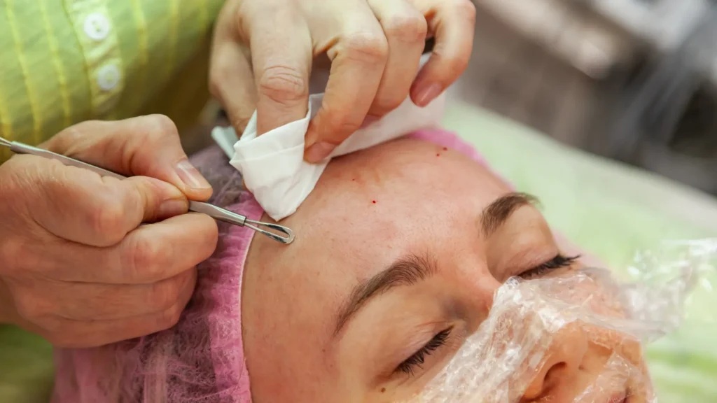 Dermatologist for Acne Treatment in East Delhi 2025