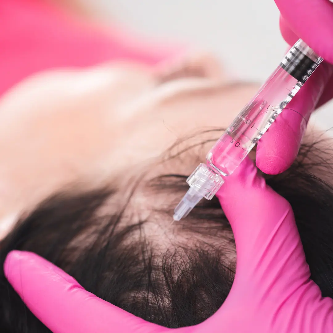 2 (1) PRP clinic in Delhi