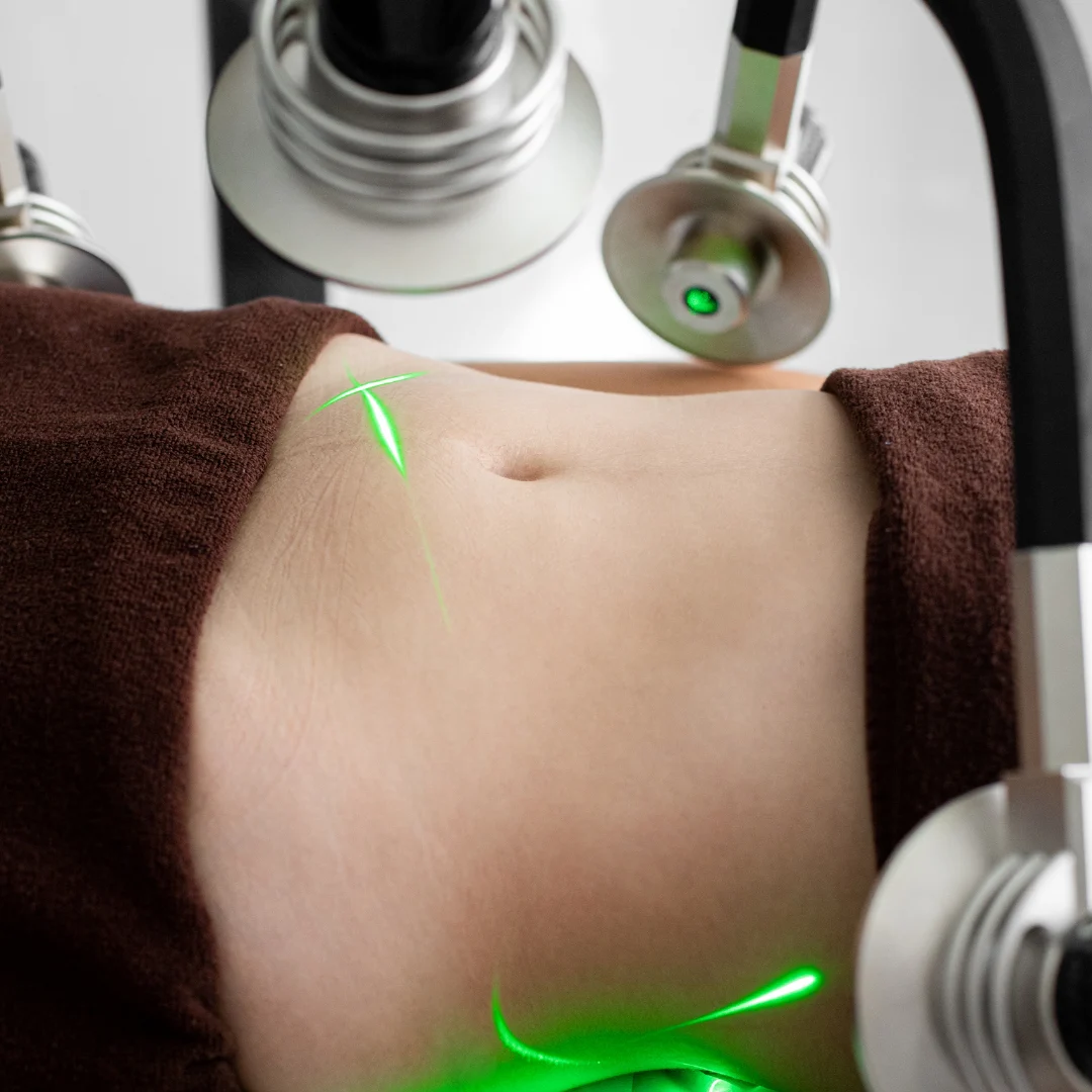 8 (2) Laser Hair Reduction