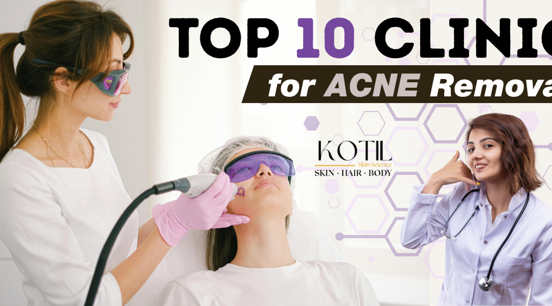 top 10 clinic for acne removal near me