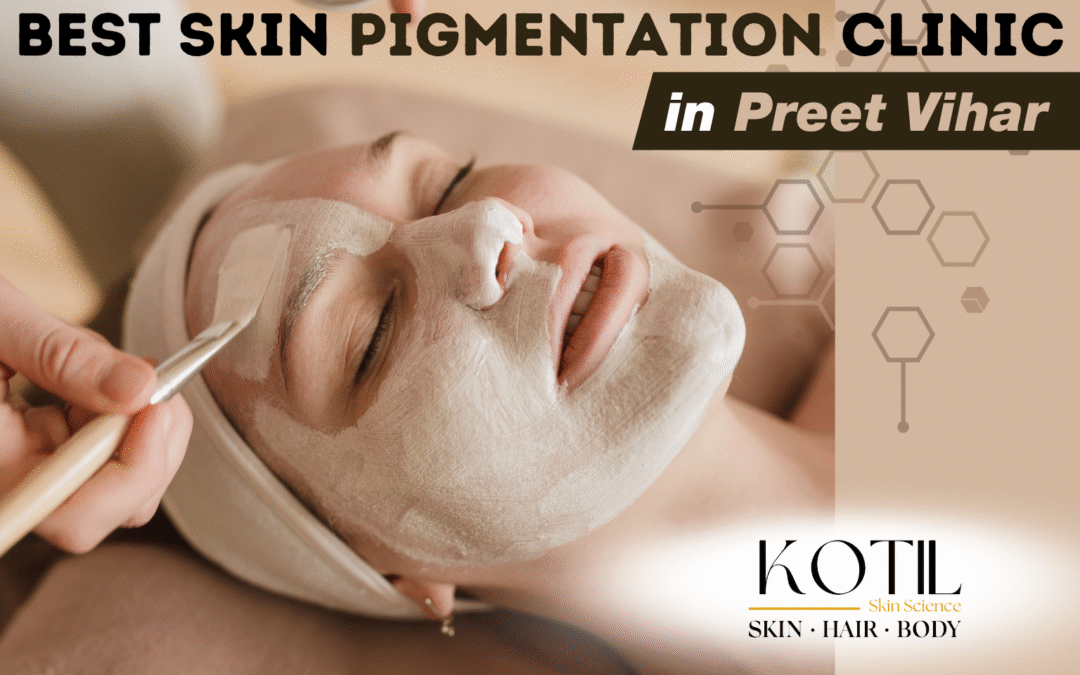 Best Skin Pigmentation Clinic in Preet Vihar