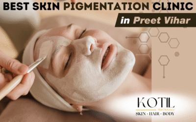 Best Skin Pigmentation Clinic in Preet Vihar 2025