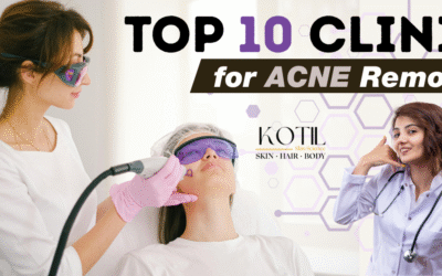 Top Clinic for Acne Removal Near Me 2025