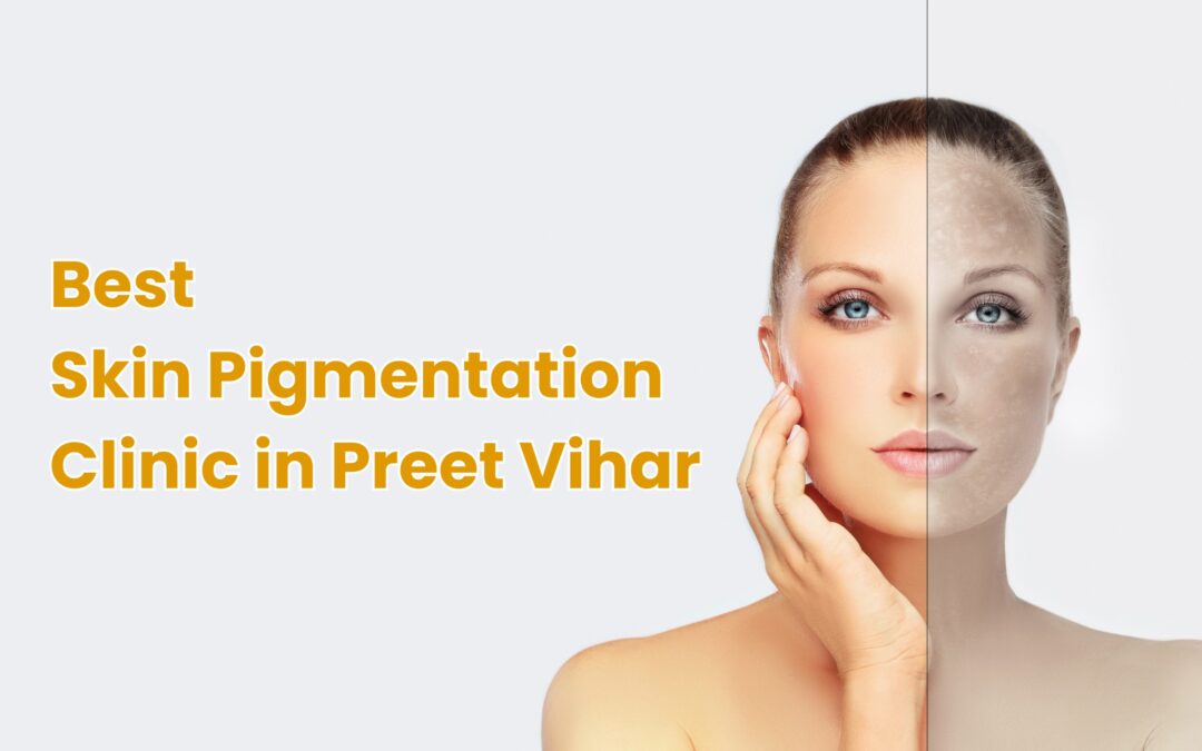 Best Skin Pigmentation Clinic in Preet Vihar