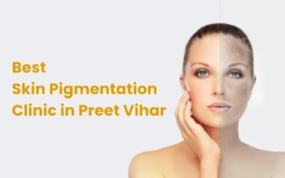 Best Skin Pigmentation Clinic in Preet Vihar 2025