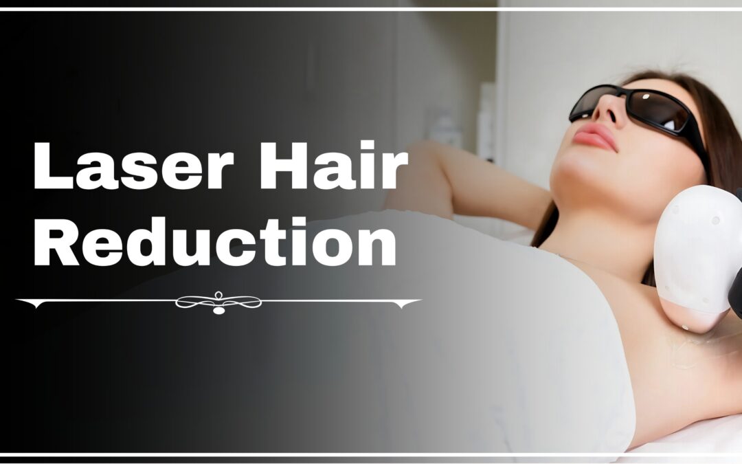 Laser Hair Removal: Everything You Need to Know 2025