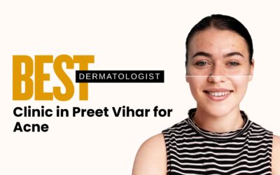 Best Dermatologist Clinic in Preet Vihar for Acne 2025