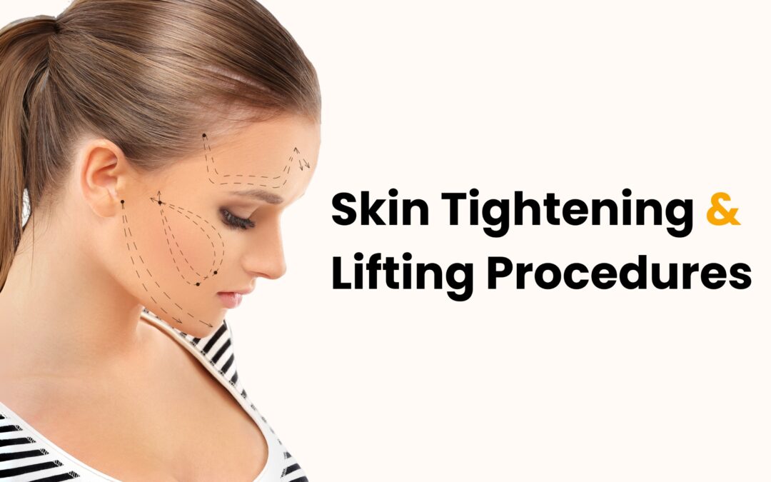 Skin Tightening & Lifting Procedures 2025: Your Complete Guide to a Firmer, Youthful Look