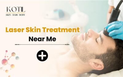 Laser Skin Treatment Near Me – Kotil skin science.