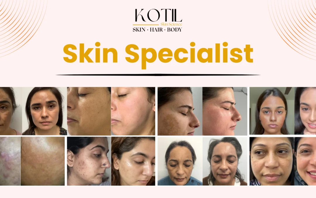 skin specialist evaluating pigmentation and melasma