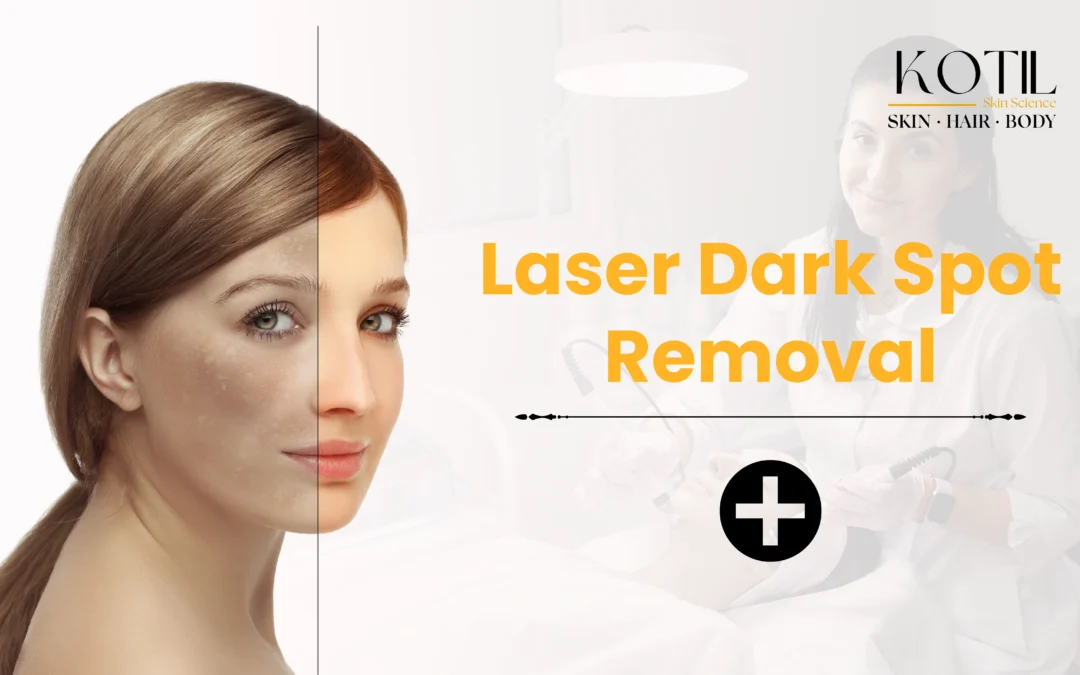 affordable dermatologist near me offering safe pigmentation and melasma care