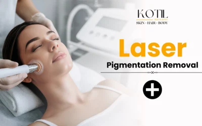 Laser Pigmentation Removal 2025: Safe and Effective Solution for Clearer Skin | Kotil Skin Science