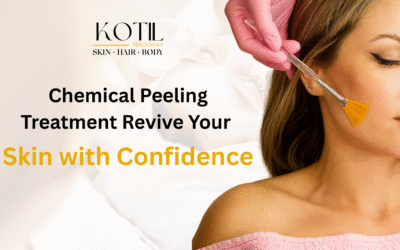 Chemical Peeling Treatment – Revive Your Skin with Confidence
