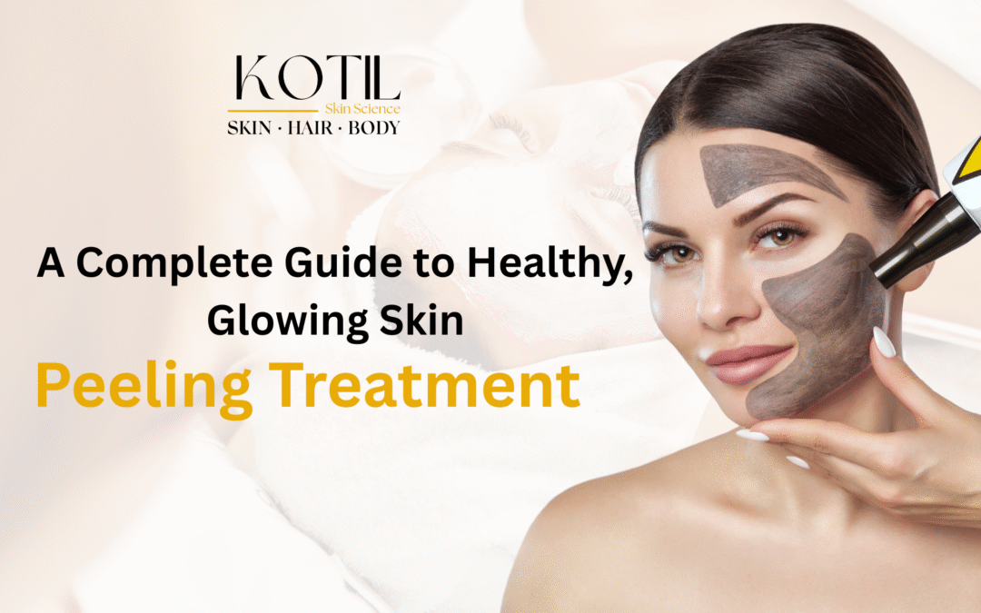 Peeling Treatment