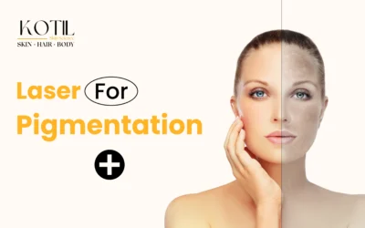 Laser for Pigmentation 2025: A Modern Solution for Clearer, Even-Toned Skin | Kotil Skin Science