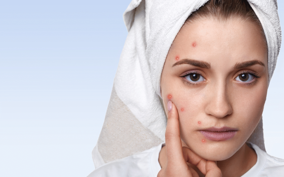 Pigmentation Treatment Clinic in Laxmi Nagar 2026- by Kotil Skin Science