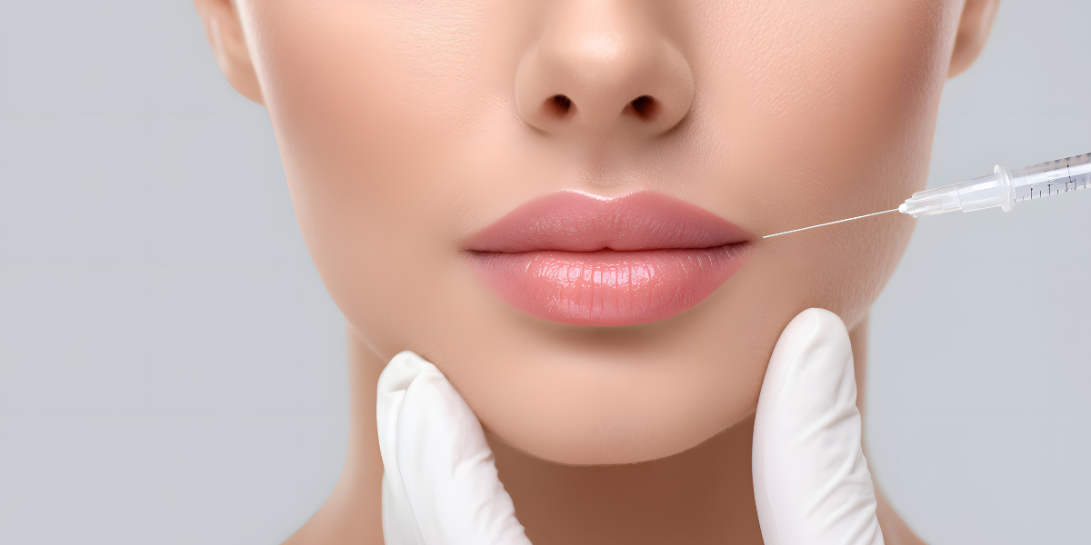 Dermal filler treatment for facial volume enhancement at Kotil Skin Science clinic