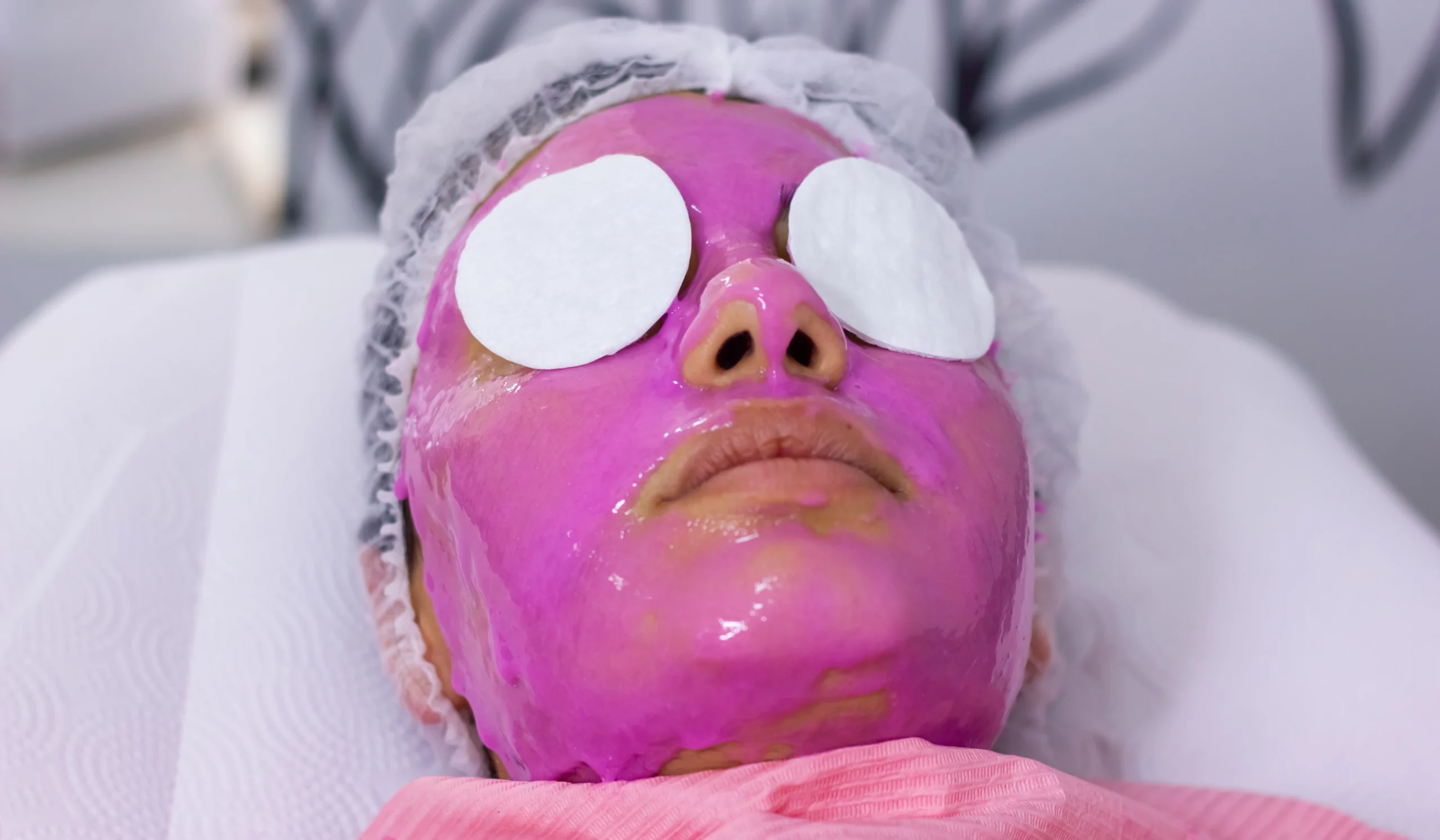 Open Pores Treatment