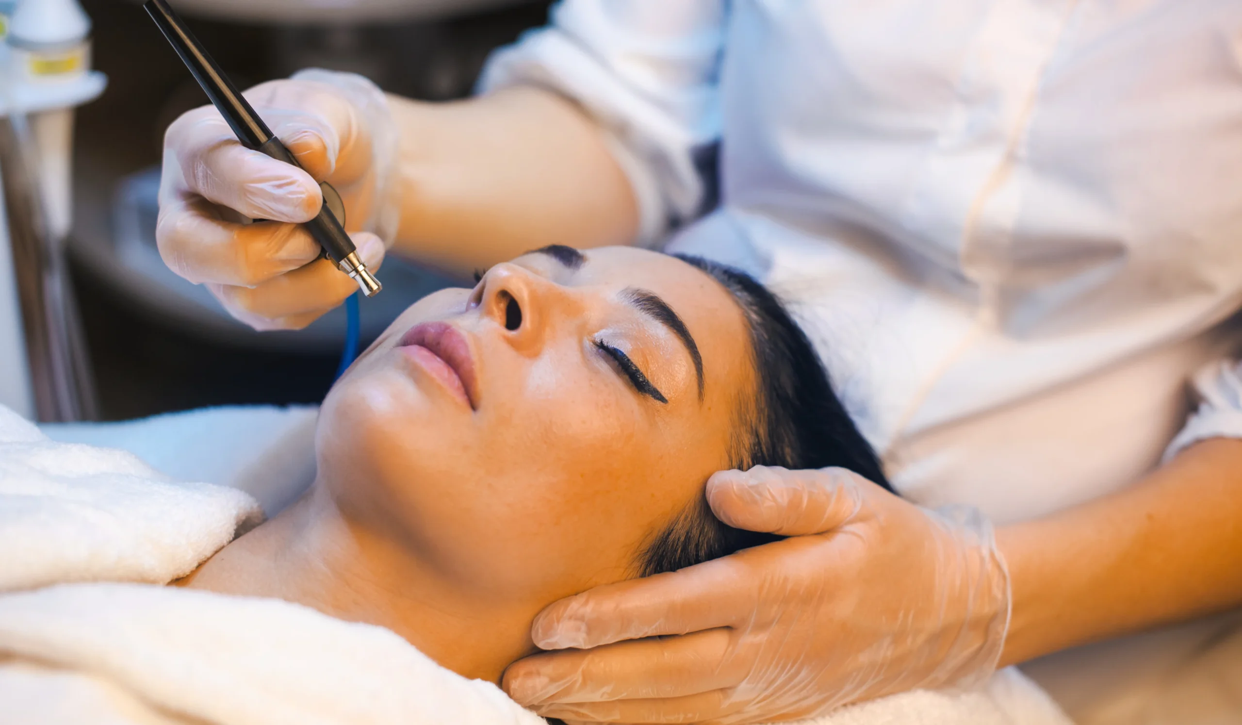 Pigmentation Treatment
