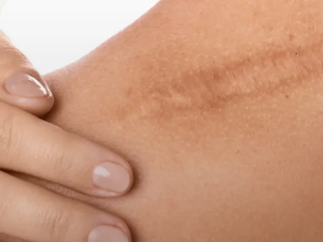 Scar Removal